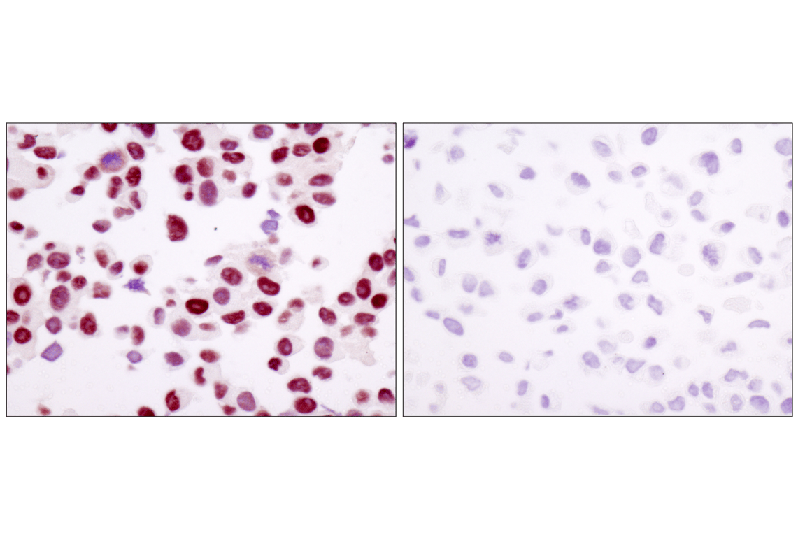 Immunohistochemistry Image 2: Androgen Receptor (D6F11) Rabbit Monoclonal Antibody (BSA and Azide Free)