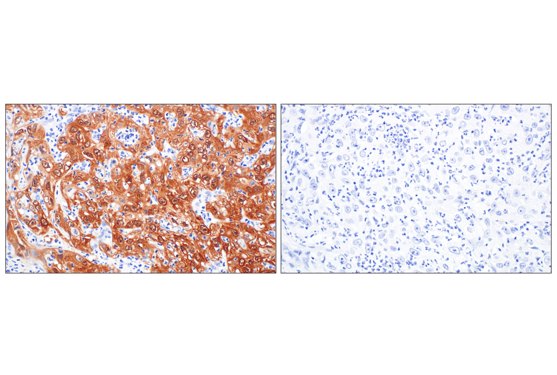 Immunohistochemistry Image 10: p16 INK4A (F9T1L) Rabbit Monoclonal Antibody