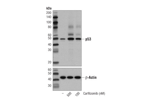 undefined Image 2: Carfilzomib
