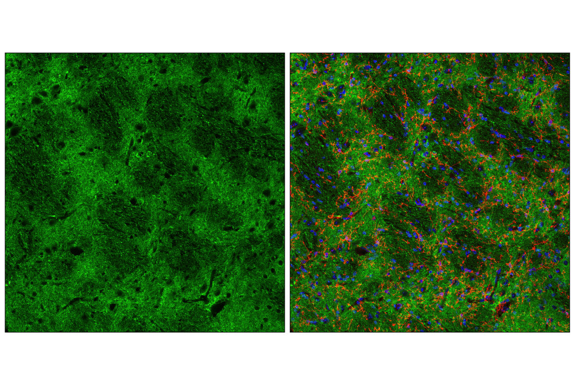 undefined Image 38: Pathological Hallmarks of Alzheimer's Disease Antibody Sampler Kit