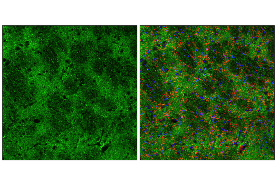 undefined Image 13: PhosphoPlus<sup>®</sup> Tau (Thr181) Antibody Duet