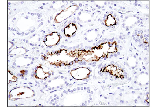 Immunohistochemistry Image 3: CD133 (D4W4N) Rabbit Monoclonal Antibody (BSA and Azide Free)