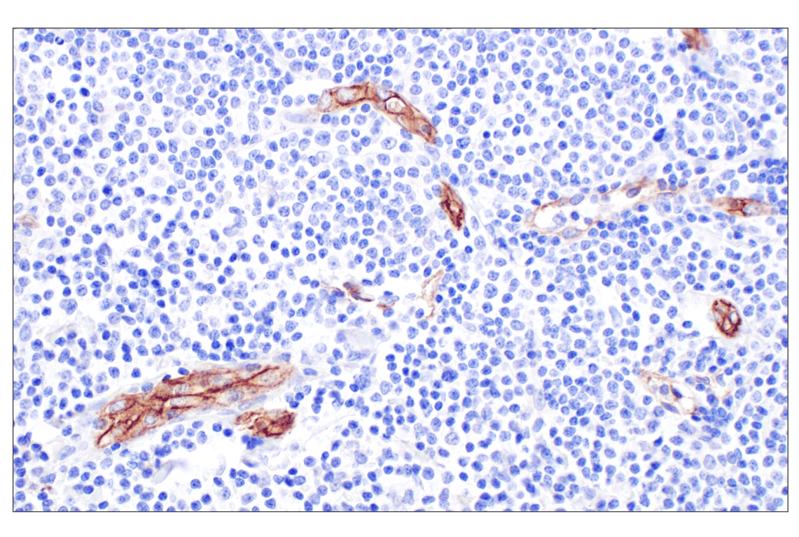 Immunohistochemistry Image 2: CD105/Endoglin (F9C5Q) Rabbit Monoclonal Antibody (BSA and Azide Free)