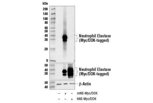 Western Blotting Image 2: Neutrophil Elastase (E8U3X) Rabbit Monoclonal Antibody