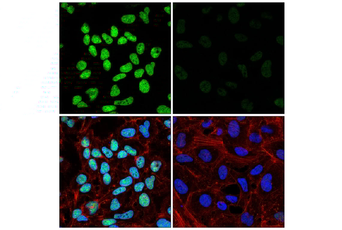 Immunofluorescence Image 1: ILF3 (E5H6F) Rabbit Monoclonal Antibody