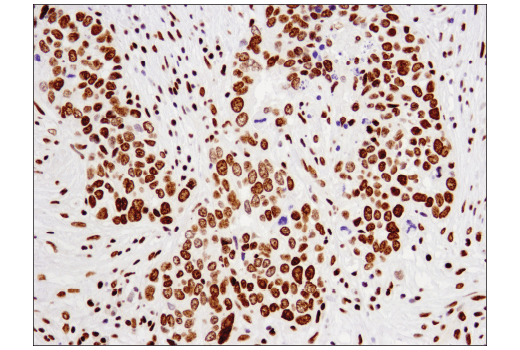 Immunohistochemistry Image 2: Acetyl-Histone H2B (Lys20) (D7O9W) Rabbit Monoclonal Antibody