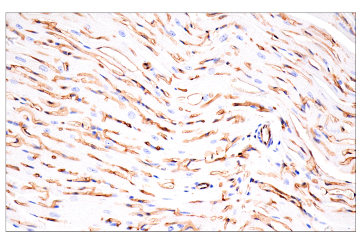 Immunohistochemistry Image 12: CD38 (E9F5A) Rabbit Monoclonal Antibody (BSA and Azide Free)