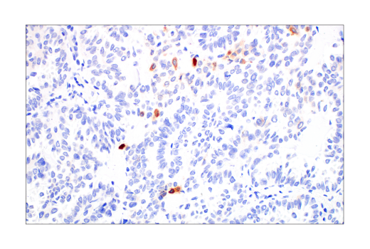 Immunohistochemistry Image 3: CYR61 (E5W3H) Rabbit Monoclonal Antibody