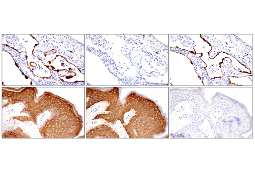 Immunohistochemistry Image 5: Pan-Keratin (5D3/LP34) Mouse Monoclonal Antibody