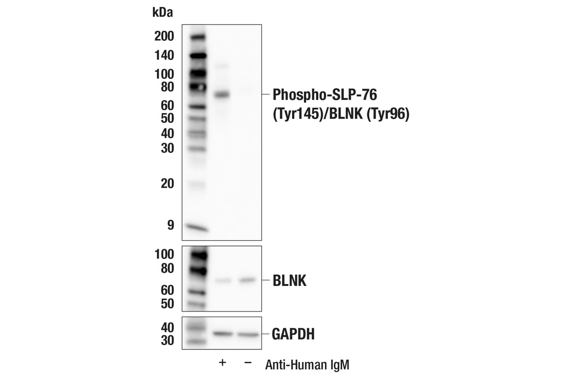 Western Blotting Image 2: Phospho-SLP-76 (Tyr145)/BLNK (Tyr96) (E9D6N) Rabbit Monoclonal Antibody