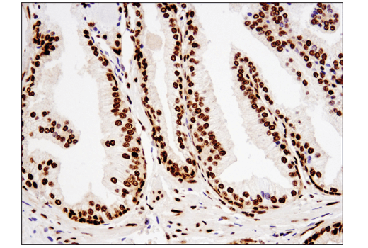 Immunohistochemistry Image 2: TDP43 (D9R3L) Rabbit Monoclonal Antibody (BSA and Azide Free)