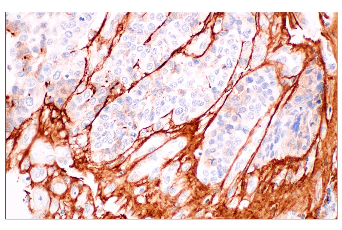 Immunohistochemistry Image 6: Tenascin C (E6N4L) Rabbit Monoclonal Antibody (BSA and Azide Free)