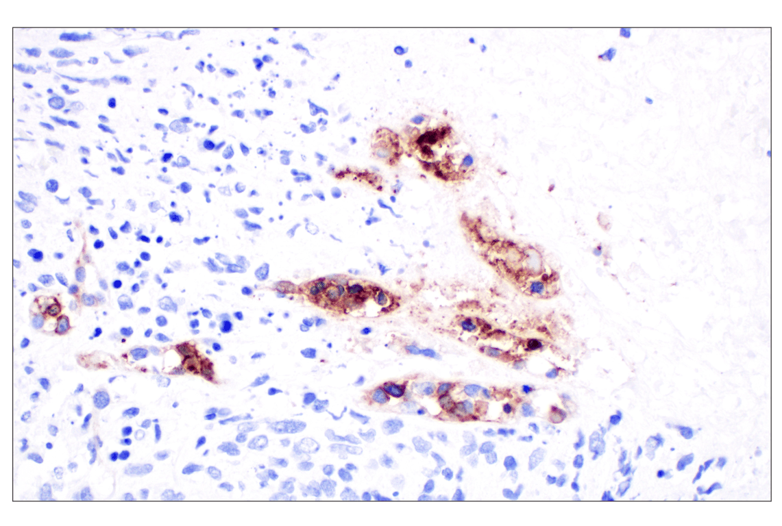 Immunohistochemistry Image 3: ALPP/ALPPL2 (F1L4G) Rabbit Monoclonal Antibody