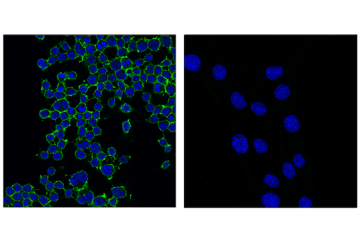 Immunofluorescence Image 1: CD45 (D3F8Q) Rabbit Monoclonal Antibody (Alexa Fluor<sup>®</sup> 488 Conjugate)