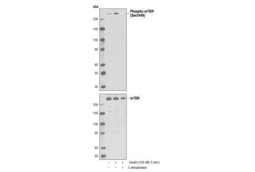 undefined Image 25: Insulin/IGF-1 Signaling Pathway Antibody Sampler Kit