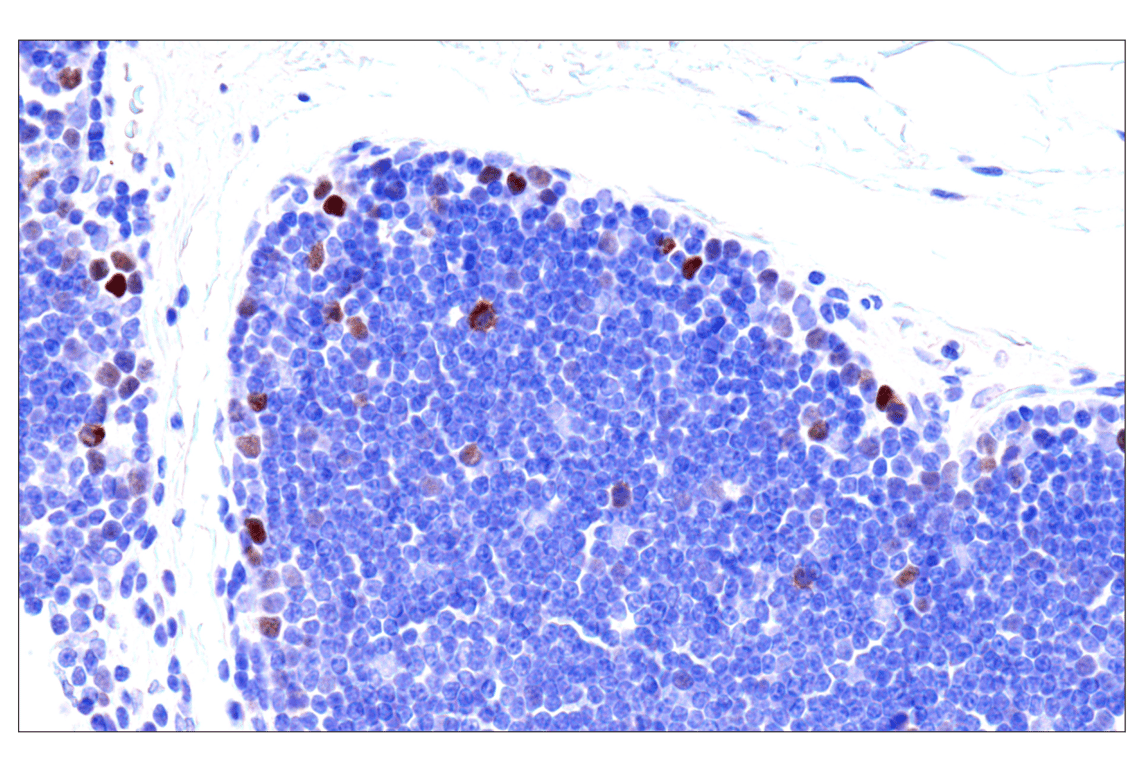 Immunohistochemistry Image 7: Phospho-NPM1 (Thr199) (E4C7S) Rabbit Monoclonal Antibody