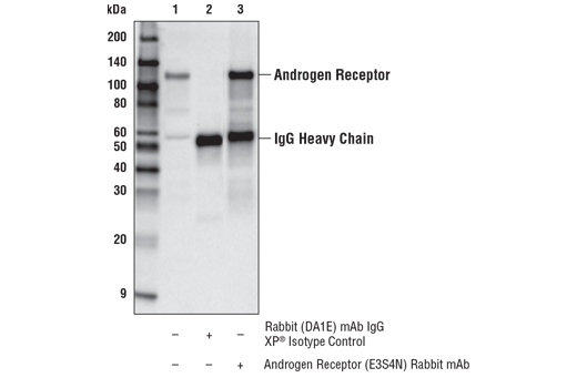 Immunoprecipitation Image 1: Androgen Receptor (E3S4N) Rabbit Monoclonal Antibody (Carboxy-terminal Antigen)