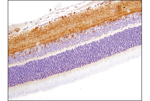 undefined Image 17: Fragile X/FMRP Signaling Pathway Antibody Sampler Kit