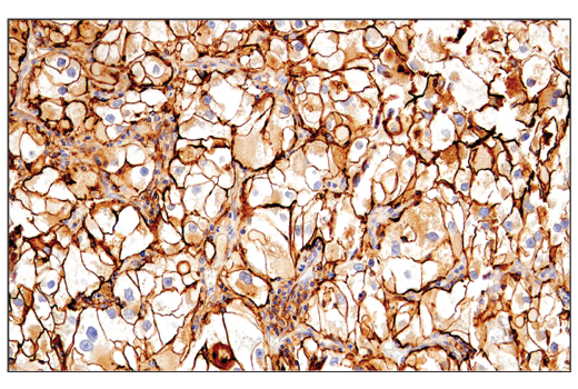 Immunohistochemistry Image 2: CD54/ICAM-1 (E3Q9N) Rabbit Monoclonal Antibody