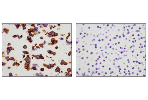 Immunohistochemistry Image 3: c-Kit (D3W6Y) Rabbit Monoclonal Antibody (BSA and Azide Free)