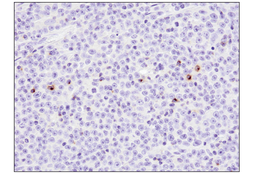 Immunohistochemistry Image 2: 4-1BB/CD137/TNFRSF9 (D2Z4Y) Rabbit Monoclonal Antibody