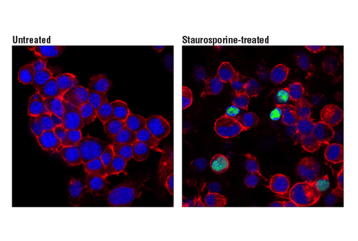 undefined Image 53: Mouse Reactive Cell Death and Autophagy Antibody Sampler Kit
