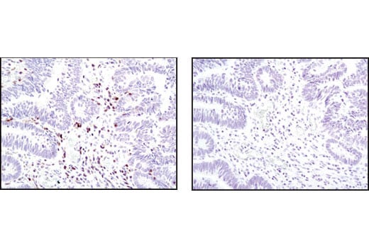 Immunohistochemistry Image 2: Fas (C18C12) Rabbit Monoclonal Antibody