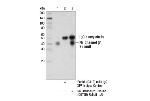Immunoprecipitation Image 1: Na Channel beta1 Subunit (D9T5B) Rabbit Monoclonal Antibody