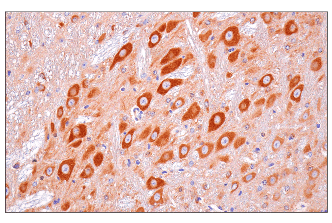 Immunohistochemistry Image 12: SPAK (F7T1K) Rabbit Monoclonal Antibody