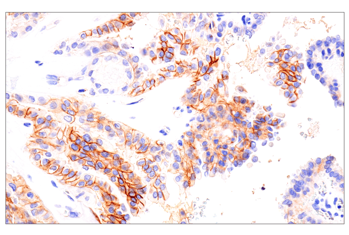 Immunohistochemistry Image 5: EphA2 (D4A2) Rabbit Monoclonal Antibody (BSA and Azide Free)
