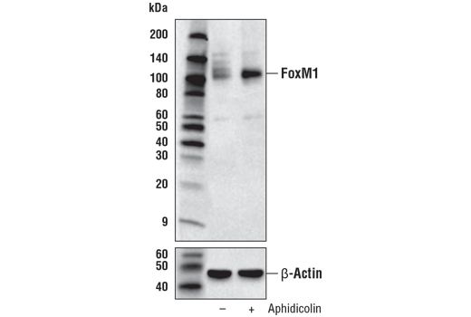Western Blotting Image 2: FoxM1 (D3F2B) Rabbit Monoclonal Antibody