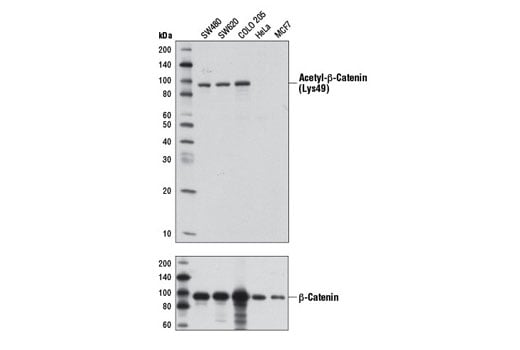 Western Blotting Image 2: Acetyl-beta-Catenin (Lys49) (D7C2) Rabbit Monoclonal Antibody