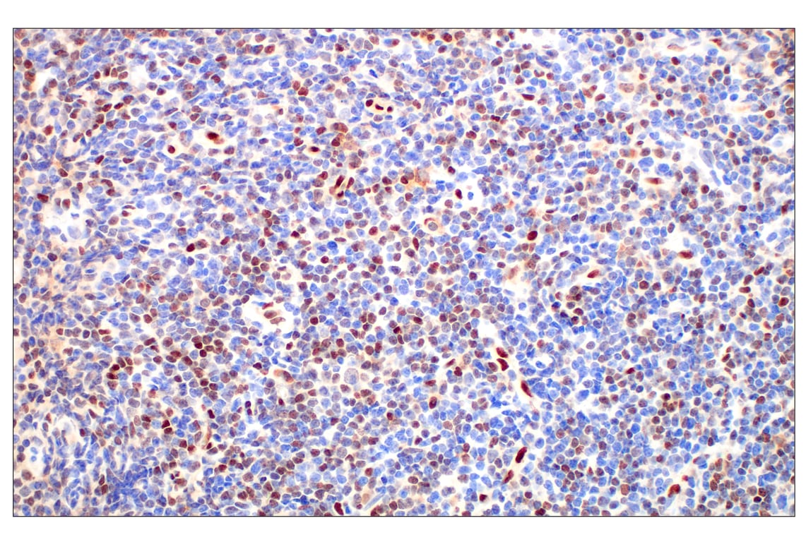 Immunohistochemistry Image 3: Basic FGF (E5Y6M) Rabbit mAb (BSA and Azide Free)