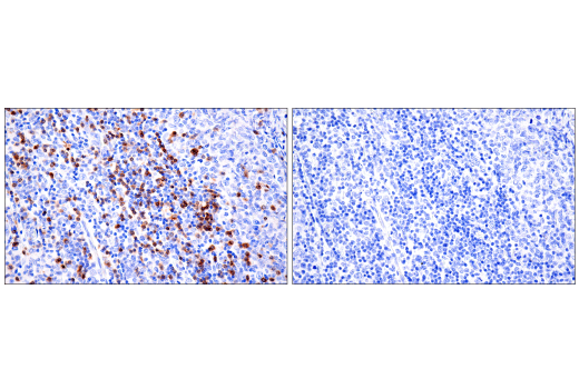 Immunohistochemistry Image 6: TRBC1/TCR beta constant region 1 (E6Z3S) Rabbit Monoclonal Antibody (BSA and Azide Free)