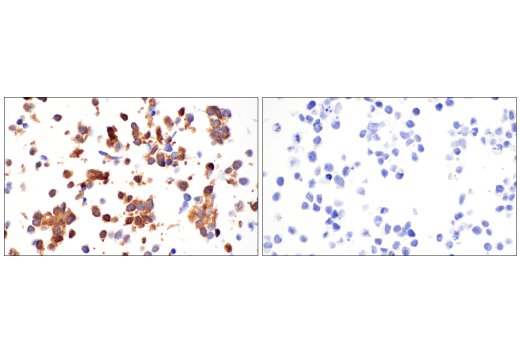 Immunohistochemistry Image 5: YAP/TAZ (E9M8G) Rabbit Monoclonal Antibody (BSA and Azide Free)