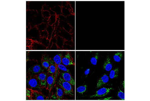 Immunofluorescence Image 1: beta-Catenin (D10A8) Rabbit Monoclonal Antibody (Alexa Fluor<sup>®</sup> 594 Conjugate)