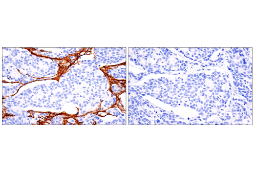 Immunohistochemistry Image 10: COL1A1 (E8F4L) Rabbit Monoclonal Antibody (BSA and Azide Free)
