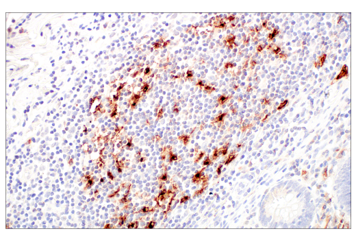 Immunohistochemistry Image 7: LAMP3/CD208 (E6E5U) Rabbit Monoclonal Antibody