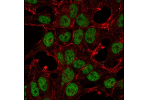 Immunofluorescence Image 1: SIN3A (D9D6) Rabbit Monoclonal Antibody