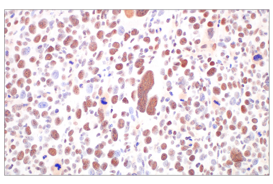 Immunohistochemistry Image 11: Basic FGF (E5Y6M) Rabbit Monoclonal Antibody