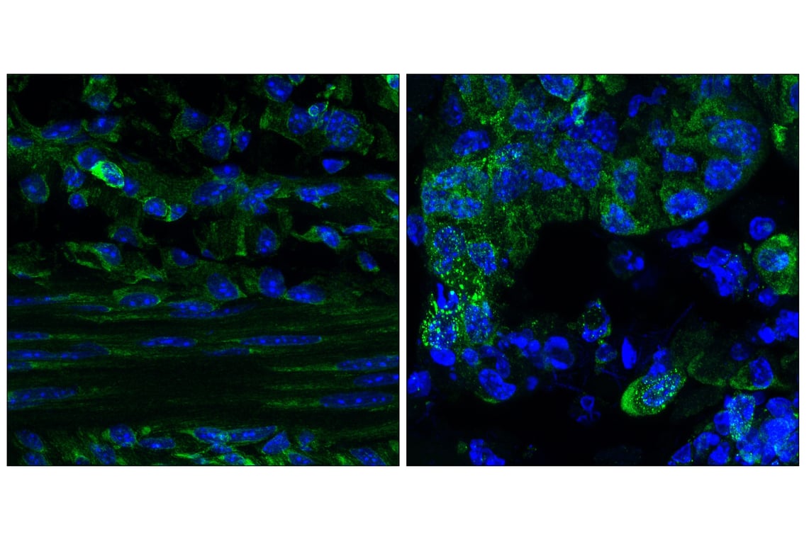 Immunofluorescence Image 1: G3bp1 (E8N8F) Rabbit Monoclonal Antibody
