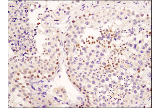 Immunohistochemistry Image 4: CHD5 (D2F9Q) Rabbit Monoclonal Antibody