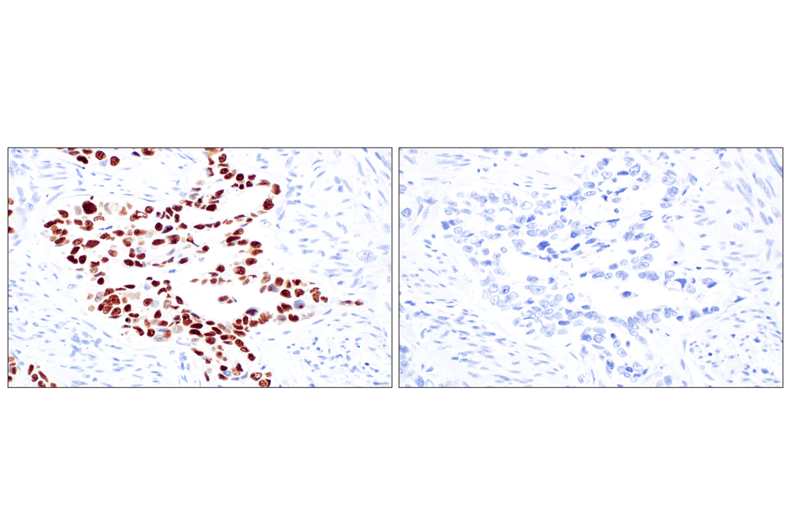 Immunohistochemistry Image 5: CT45 (F7S2I) Rabbit Monoclonal Antibody
