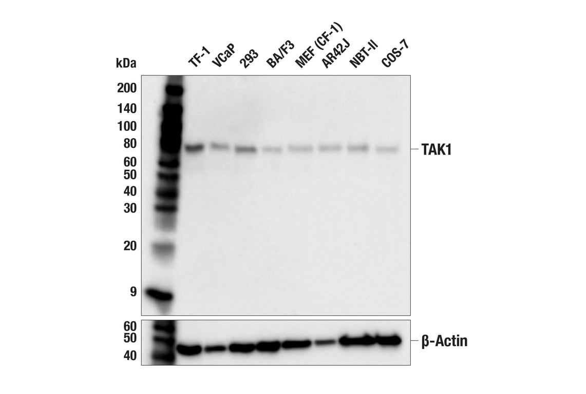 Western Blotting Image 2: TAK1 (F2R2G) Rabbit Monoclonal Antibody