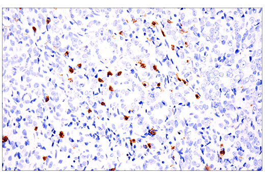 Immunohistochemistry Image 4: CD103/ITGAE (EP206) Rabbit Monoclonal Antibody