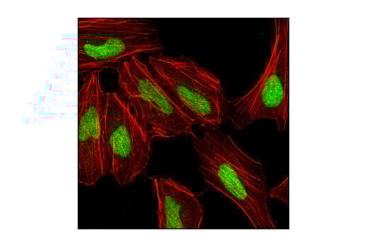Immunofluorescence Image 1: CTCF (D1A7) Rabbit Monoclonal Antibody