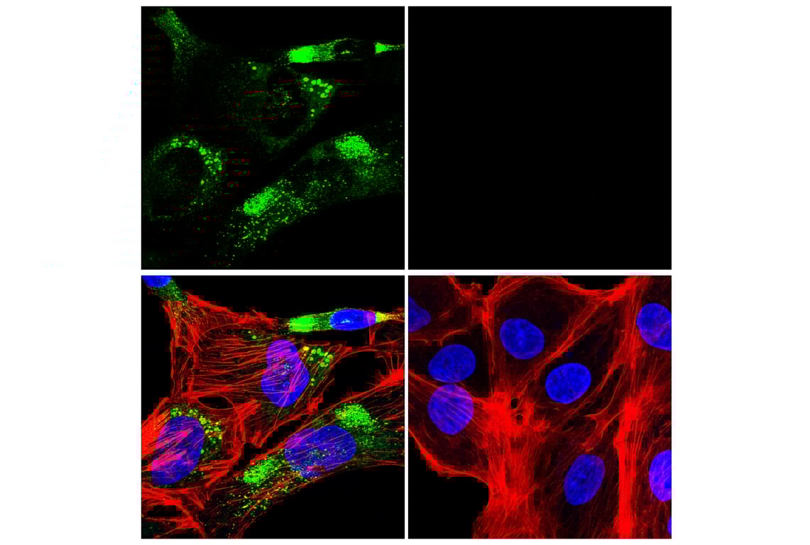 Immunofluorescence Image 1: COL3A1 (E3K9U) Rabbit Monoclonal Antibody