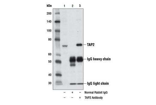 Immunoprecipitation Image 1: TAP2 Antibody