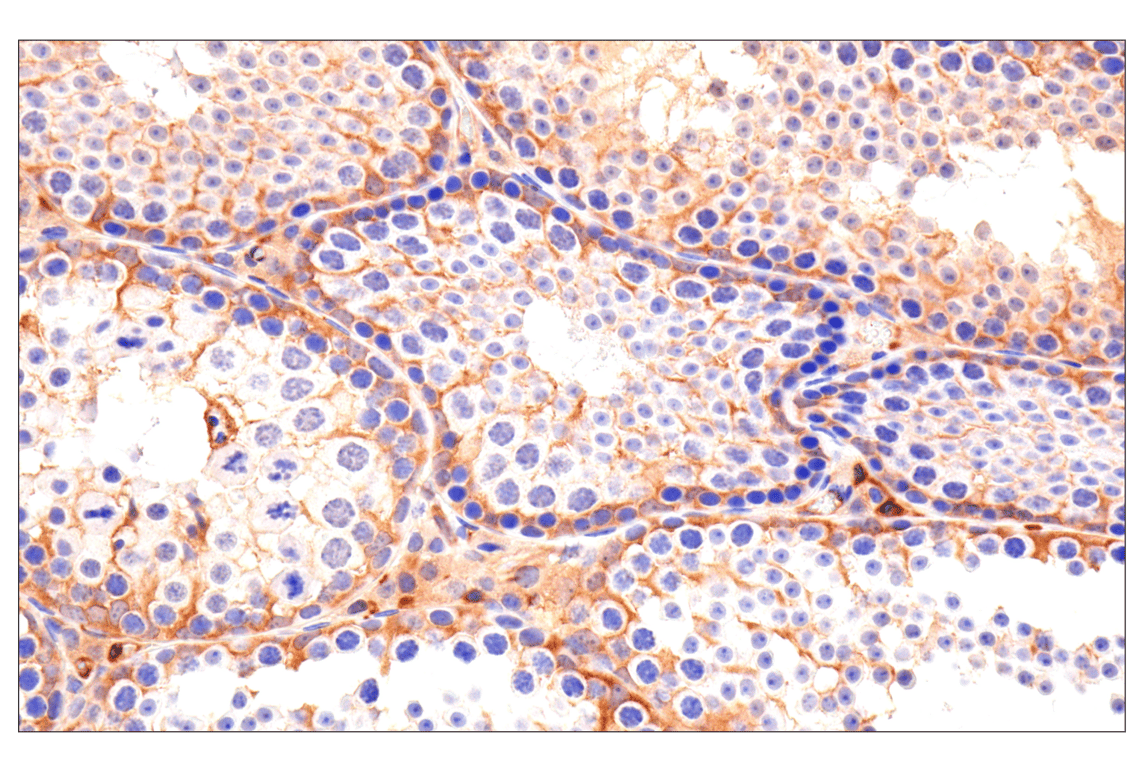 Immunohistochemistry Image 6: Caspase-8 (F5K9P) Rabbit mAb