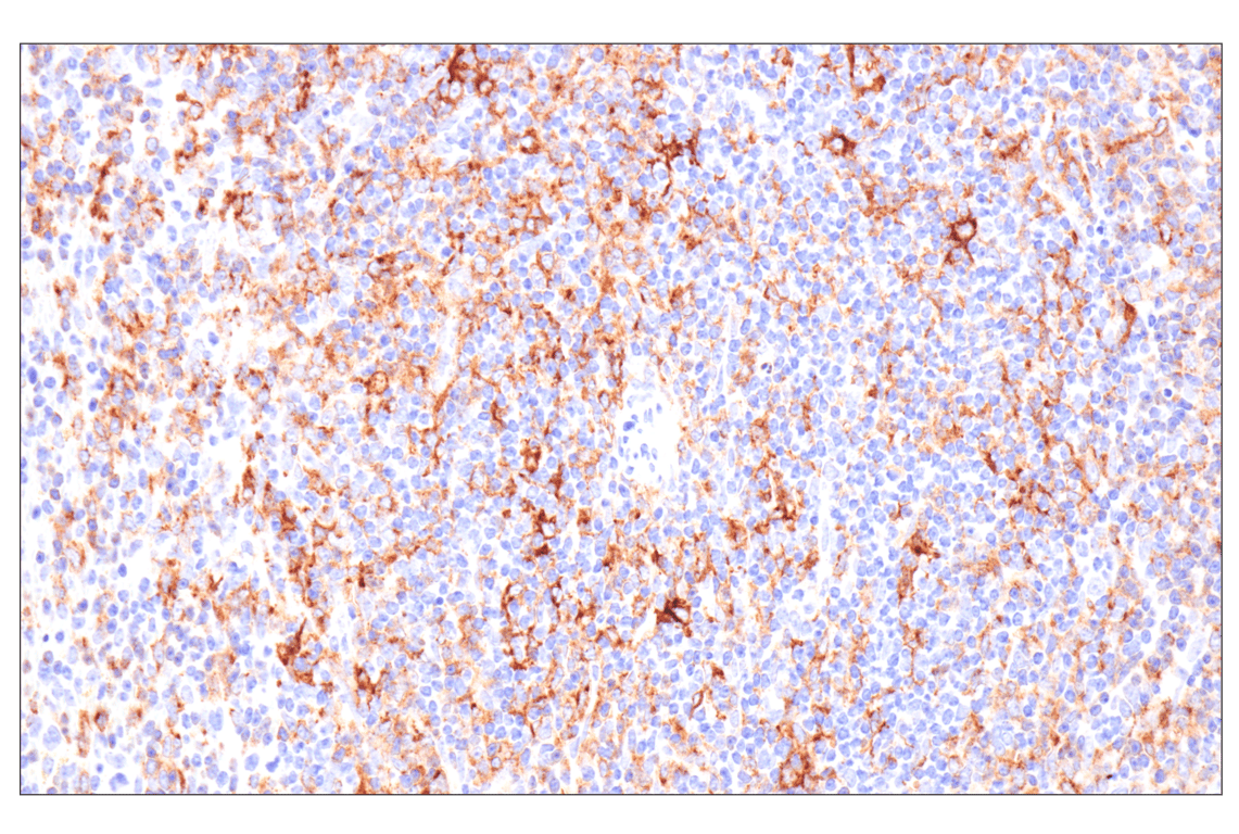 Immunohistochemistry Image 3: MHC Class II (I-E alpha) (F8N7J) Rabbit Monoclonal Antibody